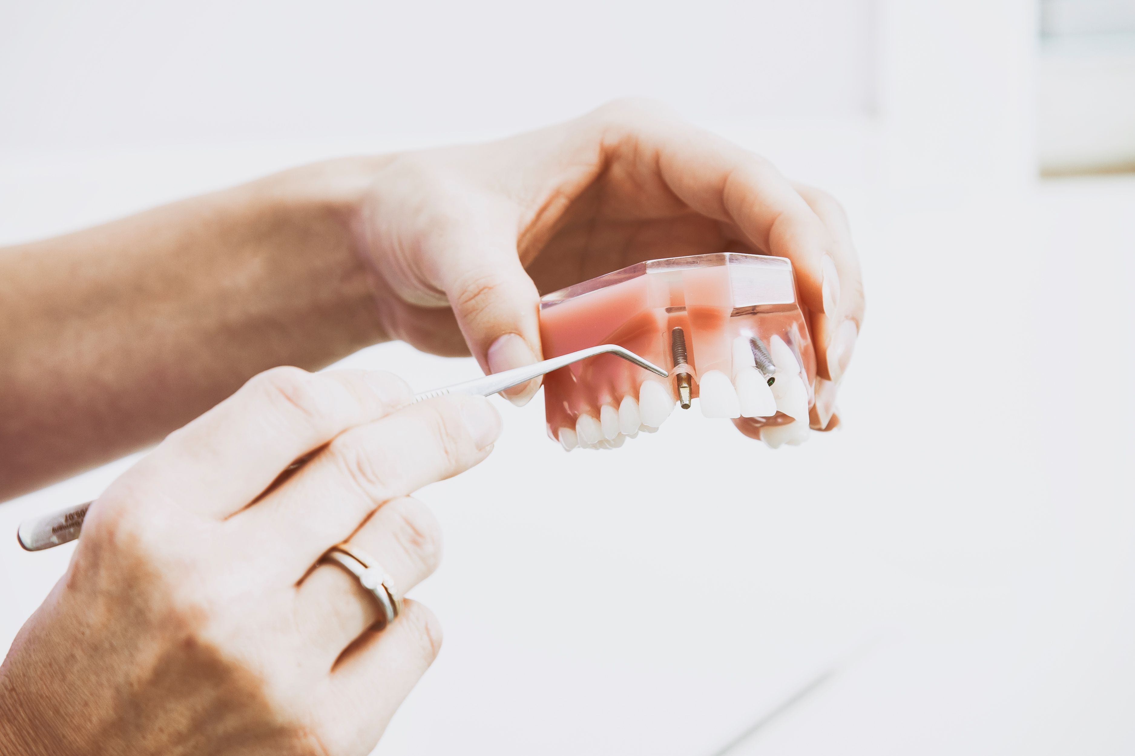 How dental implants can bring back your smile