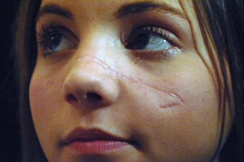 Worst Sports Injuries of the Modern Era that Devastated Careers